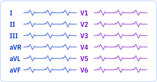 s_6x2_r0.png