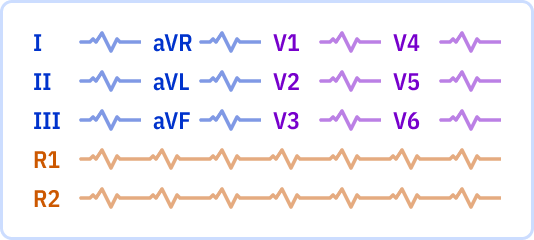 s_3x4_r2.png
