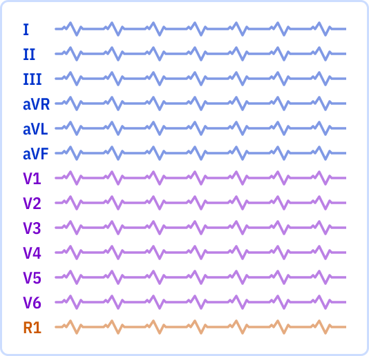 s_12x1_r1.png