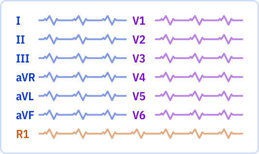 s_6x2_r1.png