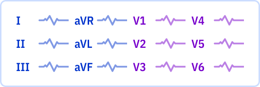s_3x4_r0.png
