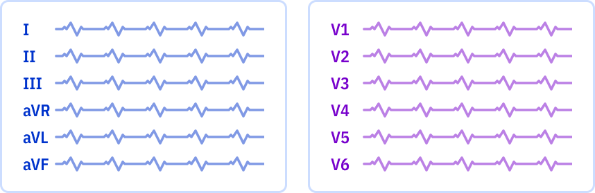 s_6x1_r0.png