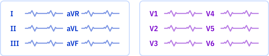 s_3x2_r0.png