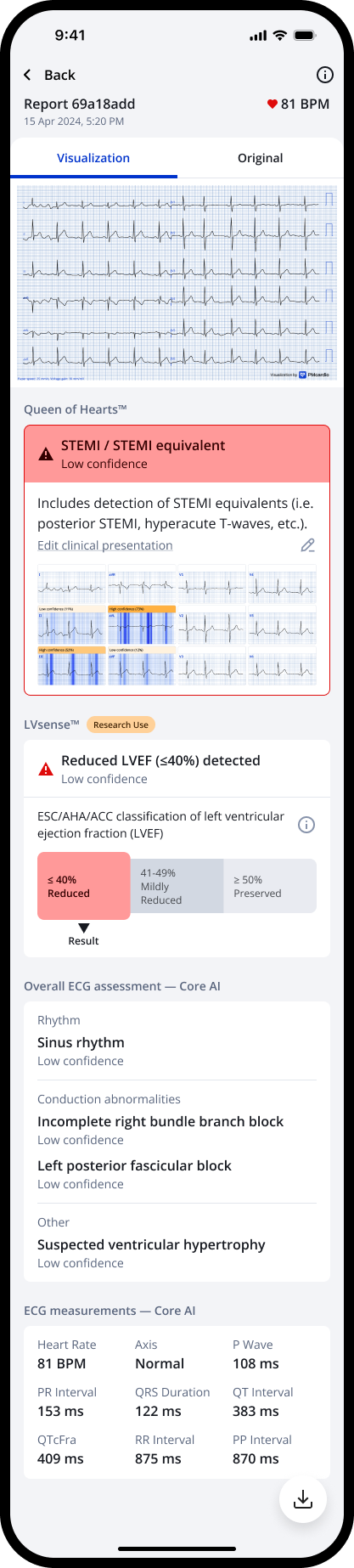reportDetail_proPlan_visualization (5).png